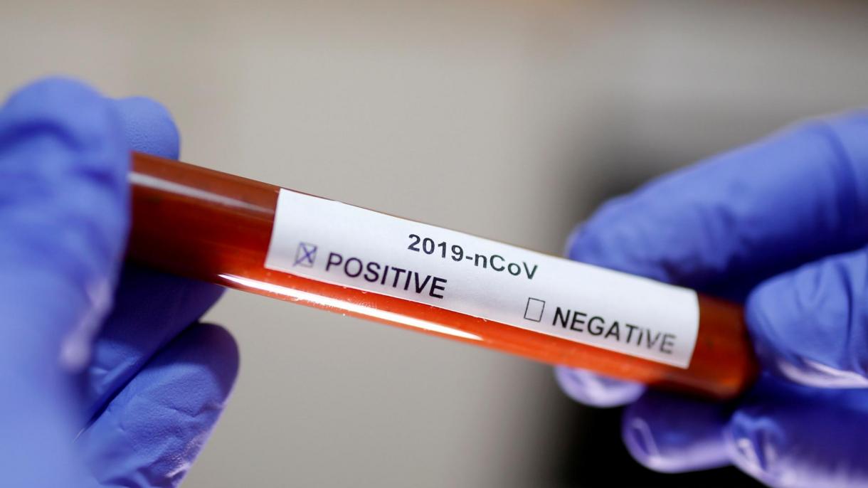 Hong Kong registra su primera muerte por el coronavirus