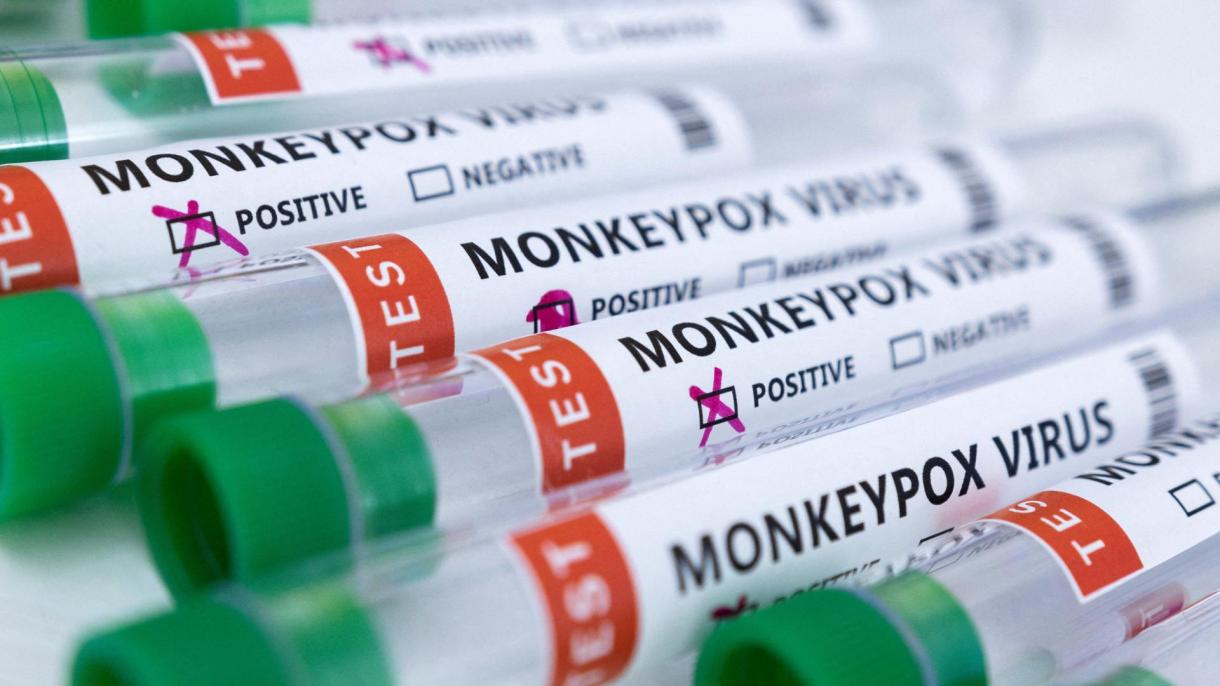 La OMS: "La viruela del mono se ha contagiado a 550 personas en 30 países en total"