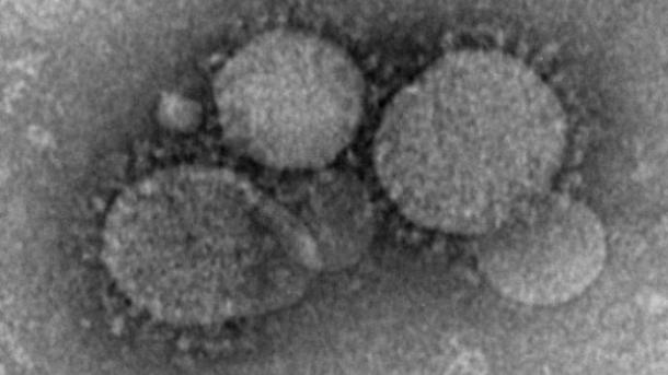 “Nature Methods”: Shkencëtarët nxjerrin “radiografinë” e parë të një virusi