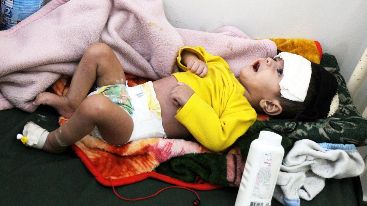 也门儿童死亡率惊人