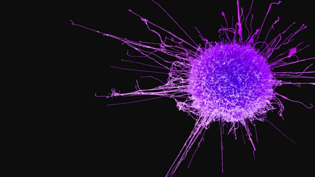 消灭癌细胞的新武器：磁球
