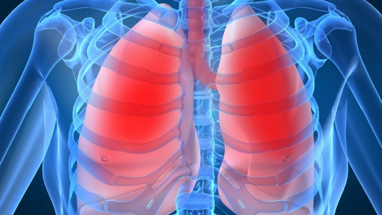 España incorpora una nueva terapia  para cáncer de pulmón