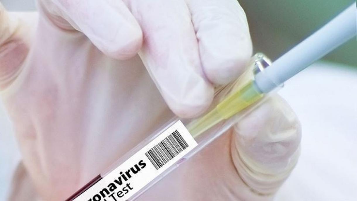 Turquie/ Coronavirus : Bilan du 22 juillet 2020