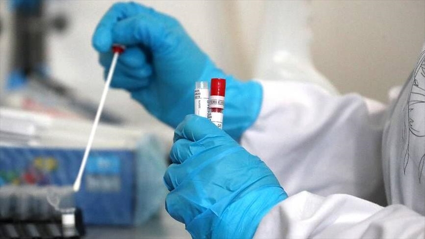 ترکی، ایک دن میں 29 ہزار 81 افراد میں کورونا وائرس کا تعین