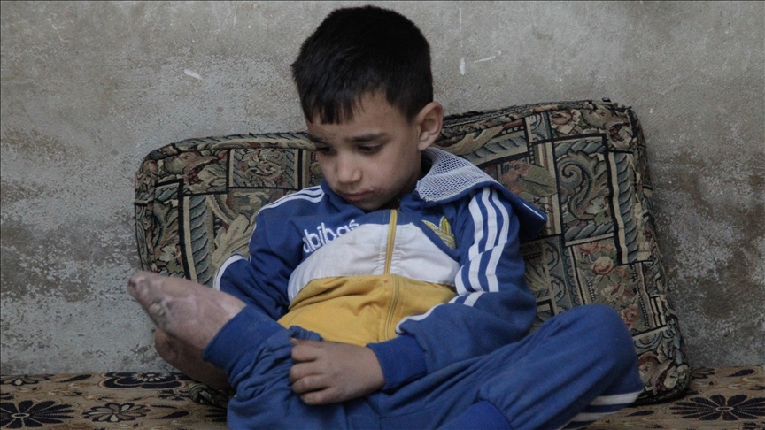 Šestogodišnji dječak koji je izgubio ruku i nogu u napadu Assadovog režima sanja da dobije proteze