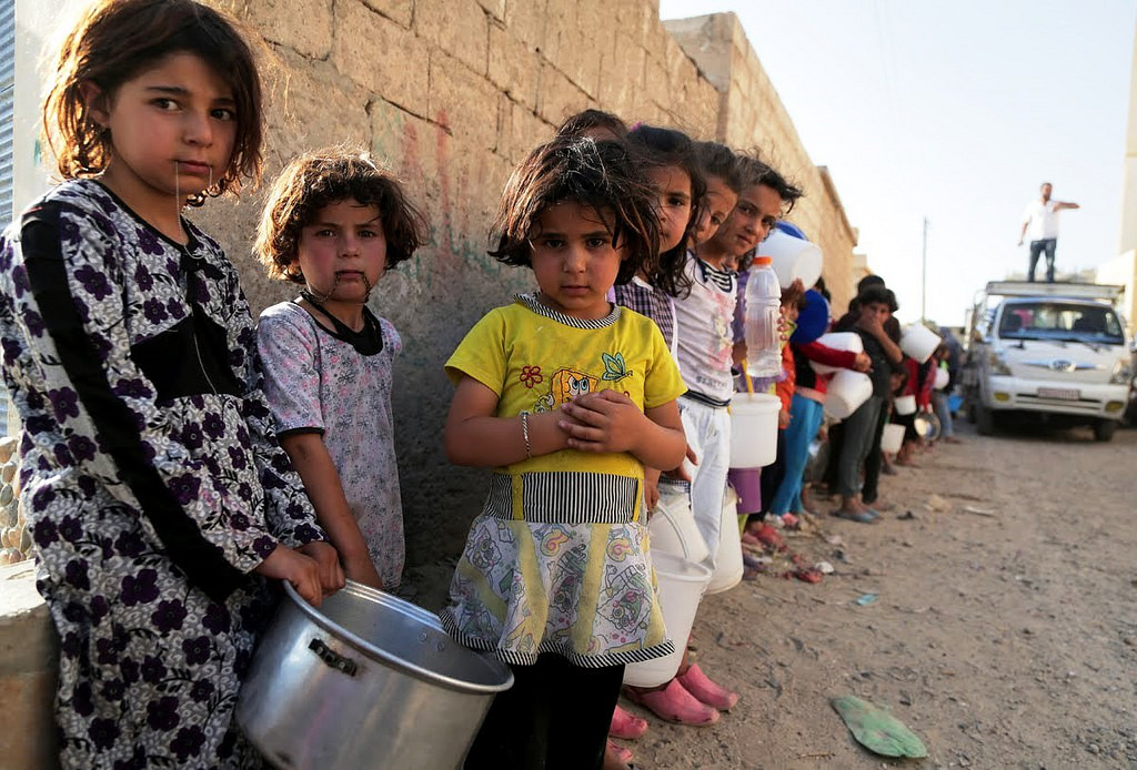 Tri četvrtine djece u Jemenu neuhranjeno