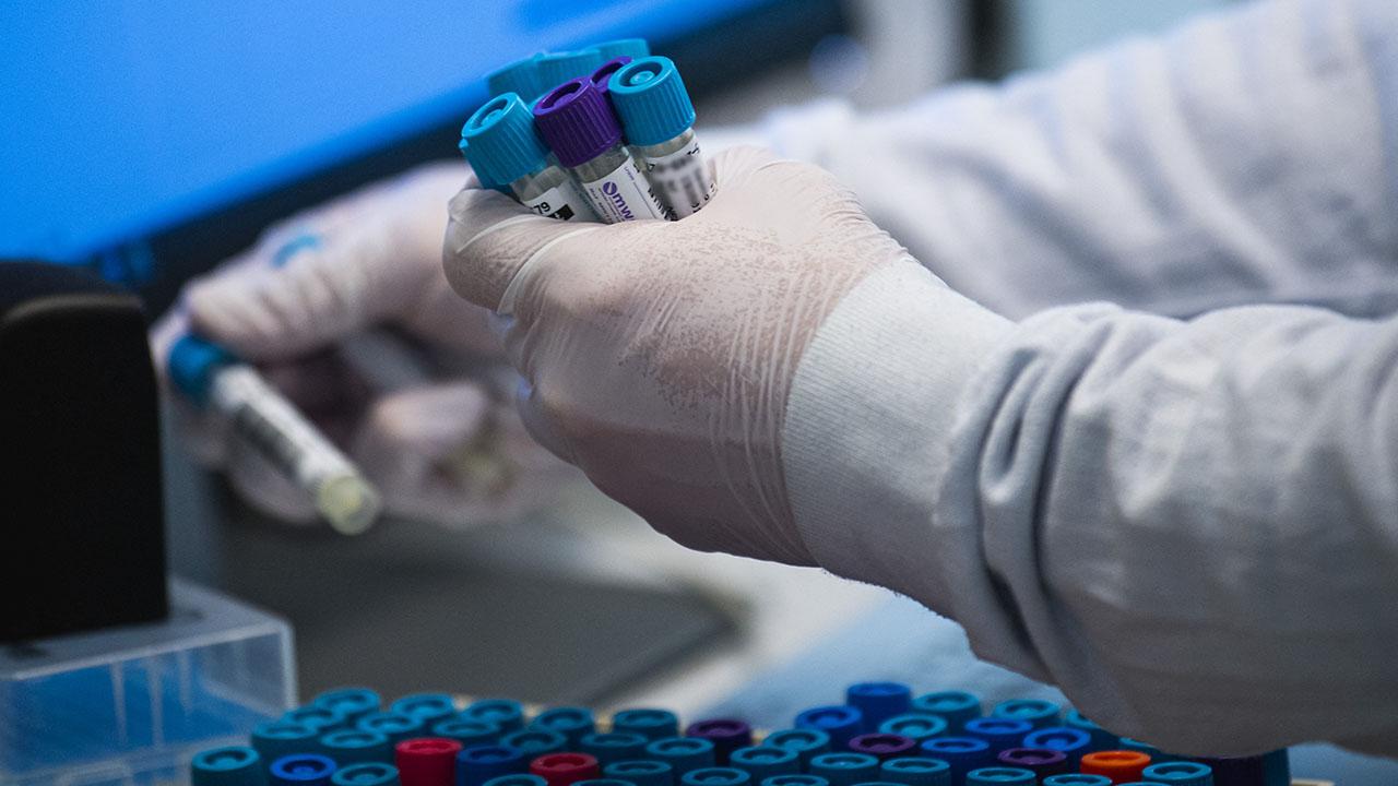 Hrvatska: Zabilježeno 27 novih slučajeva koronavirusa, dvije osobe preminule