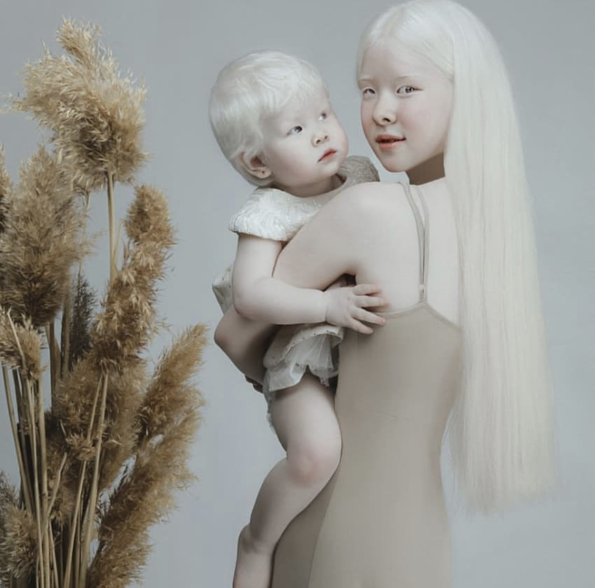 Albino  sestre, poznate kao "bele princeze", privlače pažnju modnog sveta