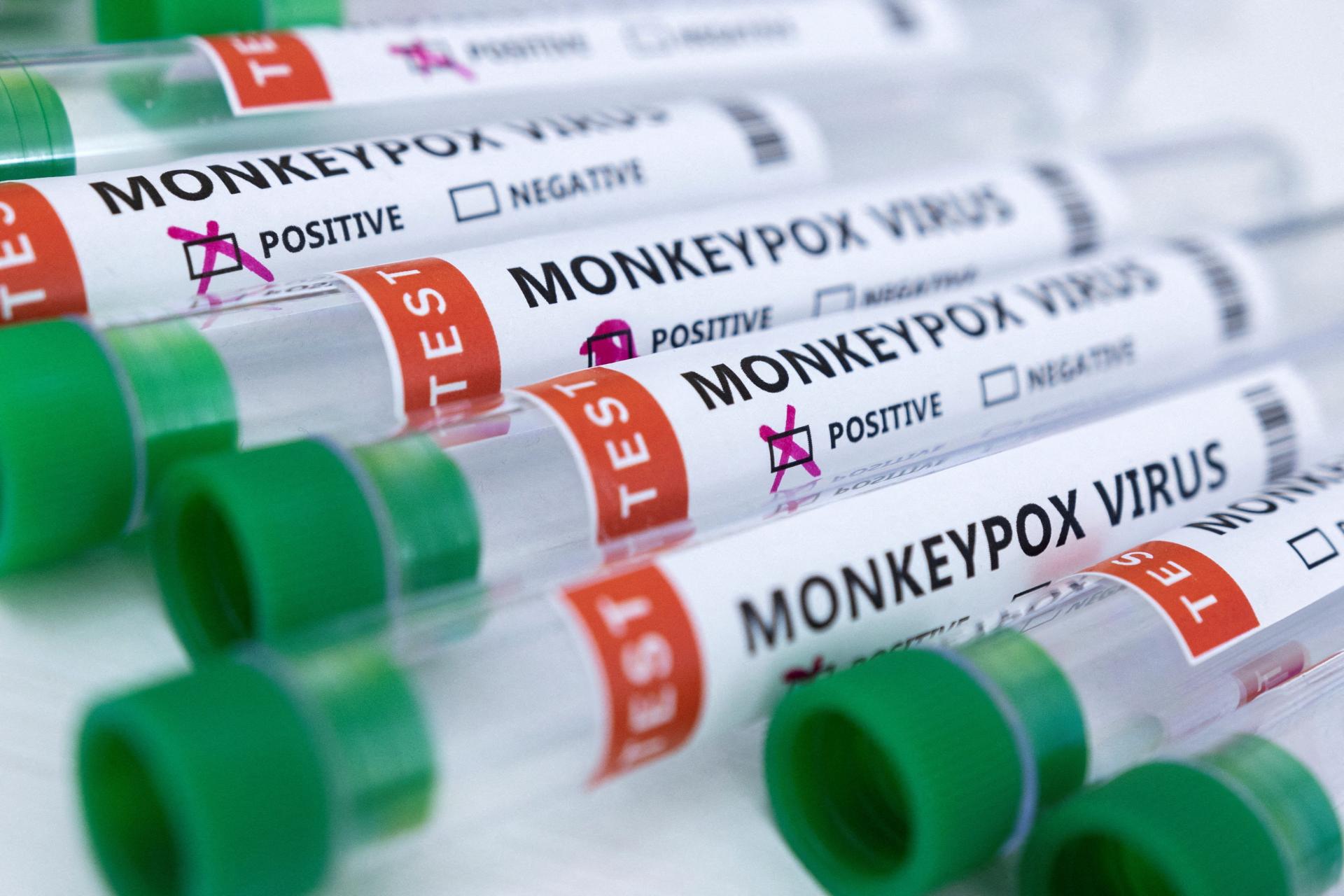 世卫组织：全球有超过 6000 例猴痘病例