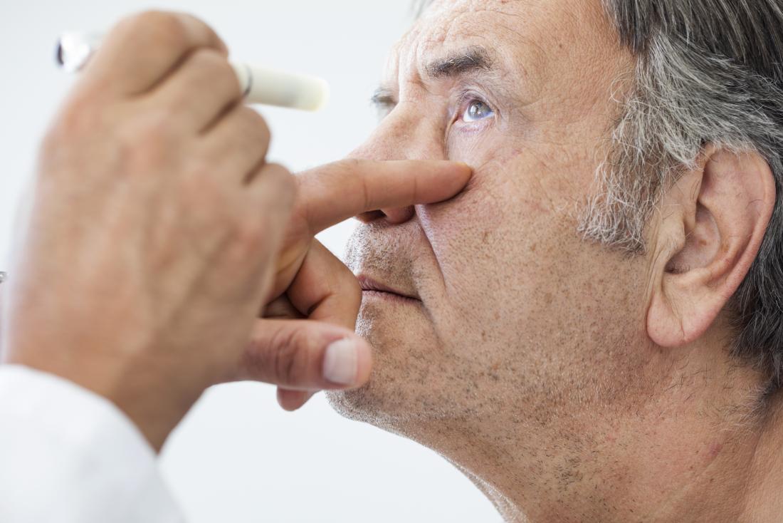 Burimi i shëndetit – Sëmundja e syve që çon në humbjen e shikimit