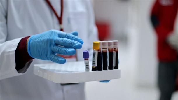 Dünyada koronavirus qurbanlarının sayı 414 mini keçib - Xәbәr ...