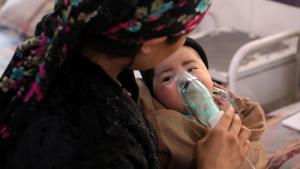 موارد سوء‌تغذیه و ذات‌الریه بین کودکان افغانی در سطح قابل توجهی رو به افزایش است
