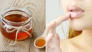За добро здравје: Природни решенија против напукнати усни