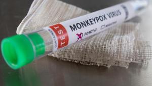 Primer caso de la viruela del mono en Panamá