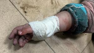 کولمبیا، اسرائیلی حملوں میں زخمی غزہ کے 50بچوں کا علاج کرے گا