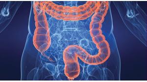 Malattie intestinali possono essere causate dall'acido desossiribonucleico.