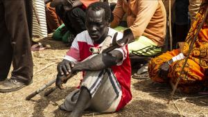 苏丹正在成为饥荒危机最严重的国家