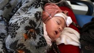 La OMS ha advertido sobre el aumento de casos de polio y de rubéola en Yemen