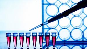 Dnevna cena PCR testova u Sloveniji premašuje milion eura