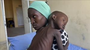 Minden harmadik gyermek néz szembe súlyos éhinséggel Nigériában