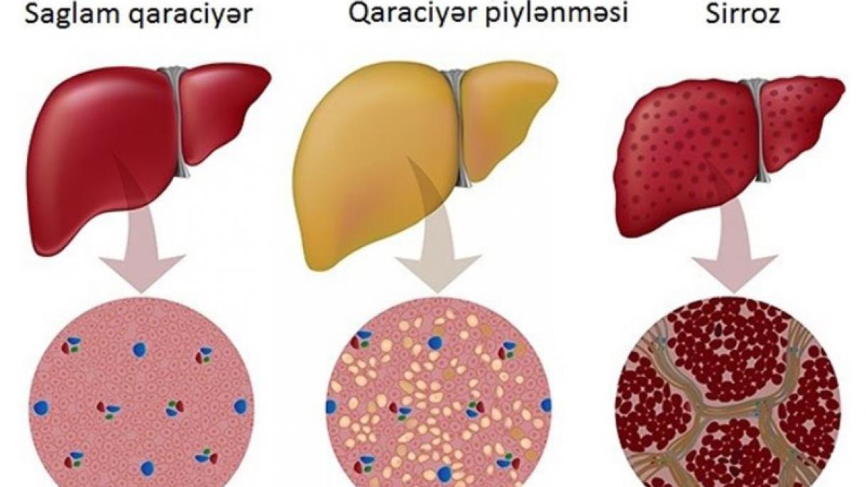 Artykmaç ýaglarymyz we saglygymyz…