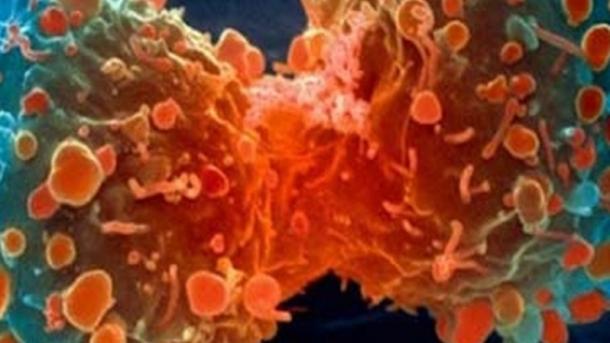 Nuestro cuerpo lucha contra un millón de células de cáncer 