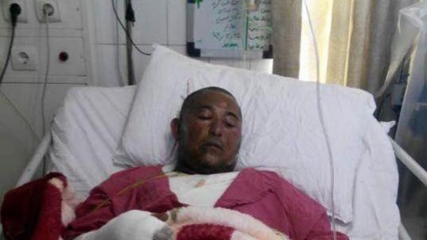 دستفروش معترض خرمشهری به دلیل سوختگی شدید درگذشت