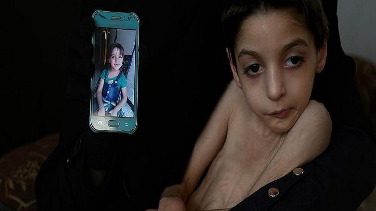 کودکان سوری در محاصره رژیم اسد جان می دهند