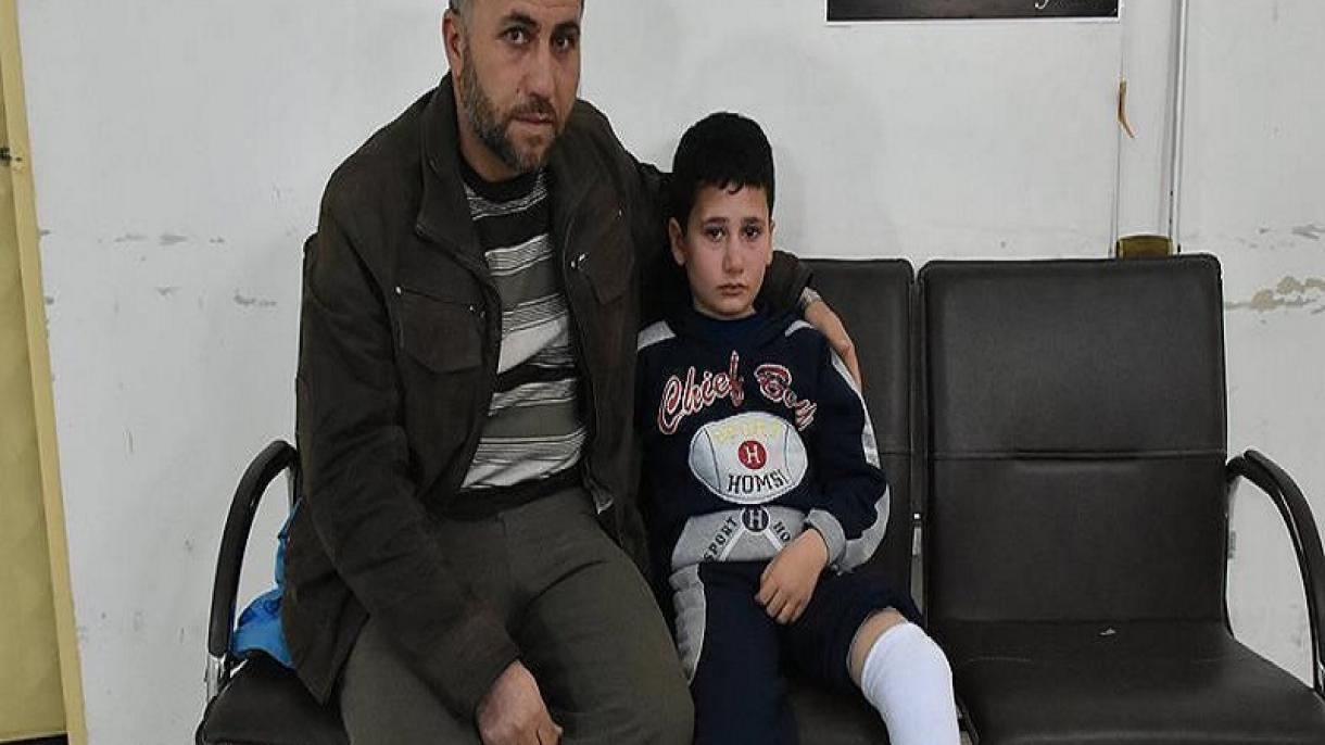 کودک قطع عضو سوری در ترکیه درمان شد