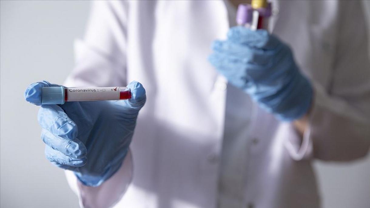 ارسال 26 هزار کیت تشخیص کرونا ویروس از سوی ترکیه به کلمبیا