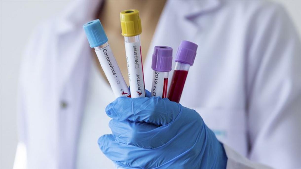 Coronavirus/Turquie: le nombre de morts s’élève à 501