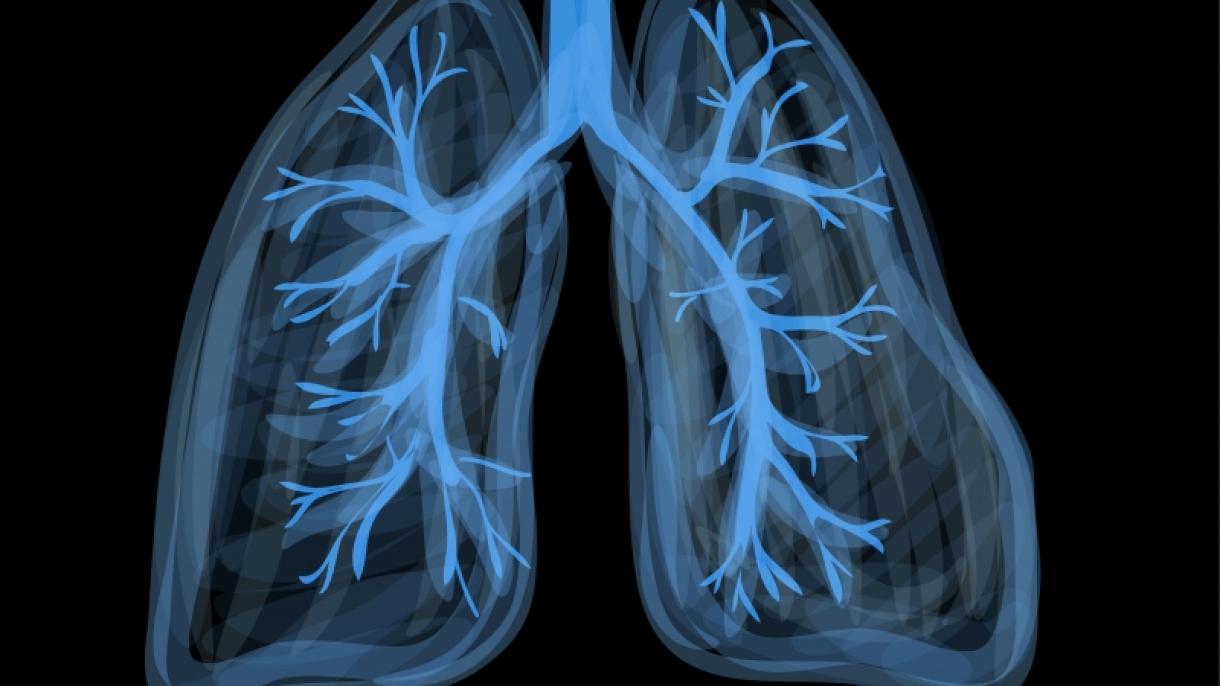 Új módszer a tüdőrák kimutatására