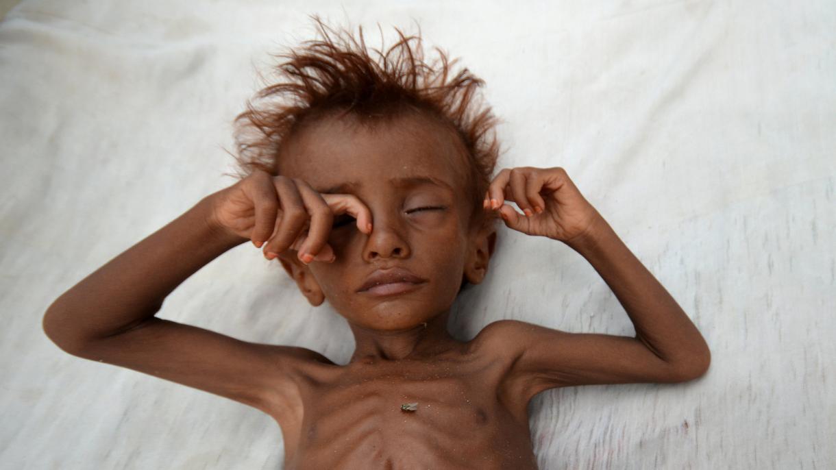 یمن-ده 6 میلیون‌دان چوخ اوشاق وطنداش محاربه‌سیندن بیرباشا اذیت چکیر