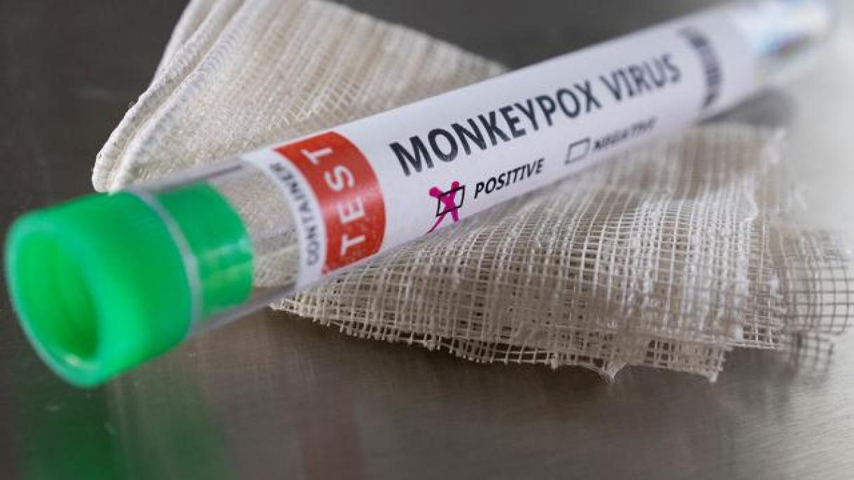 شناسایی اولین مورد ویروس آبله میمون در لیبریا