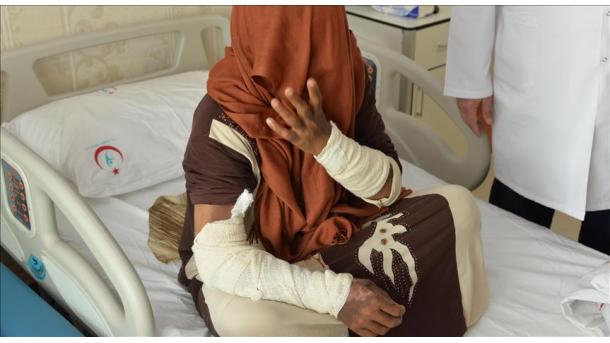 22 turcomanos recebem tratamento em Ancara após ataque químico