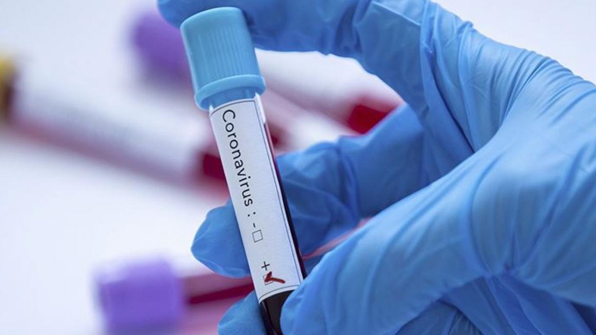 کورونا وائرس: اموات کی تعداد 12 لاکھ 56 ہزار 560 سے تجاوز کر گئی