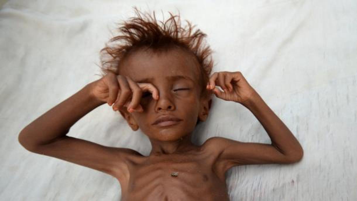 Mais de 6 milhões de crianças no Iêmen sofrem diretamente com a guerra civil desde 2014