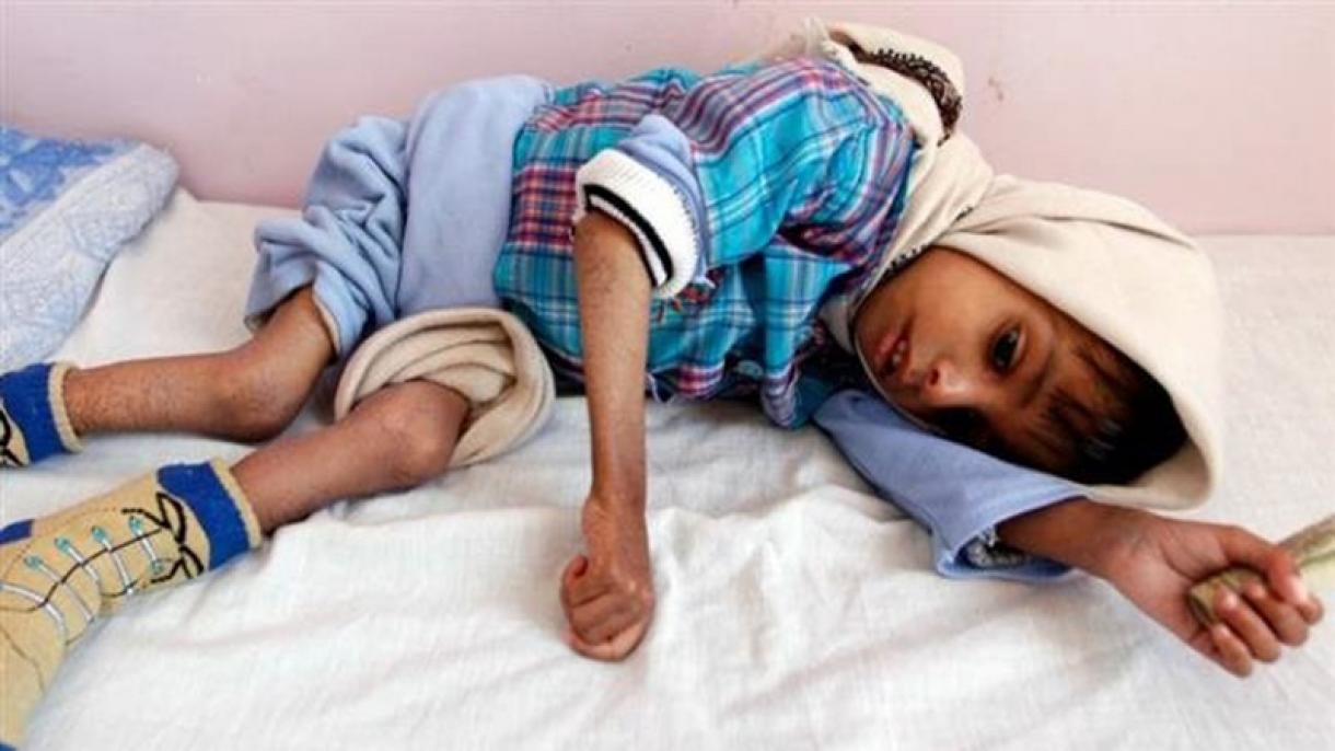 12 milhões de iemenitas enfrentam a fome