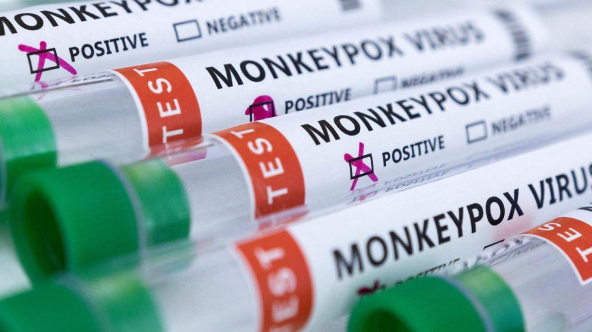 ویروس آبله میمون در غنا نیز شناسایی شد