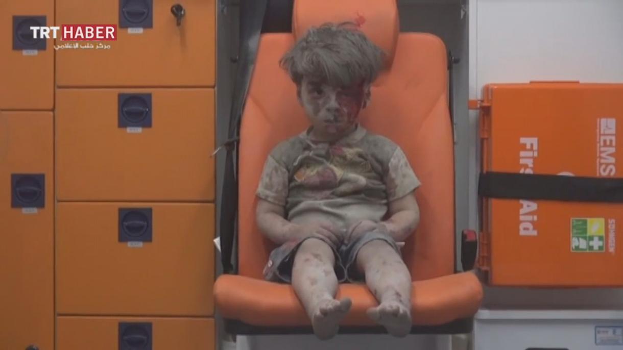 叙利亚儿童令人类羞愧的表情