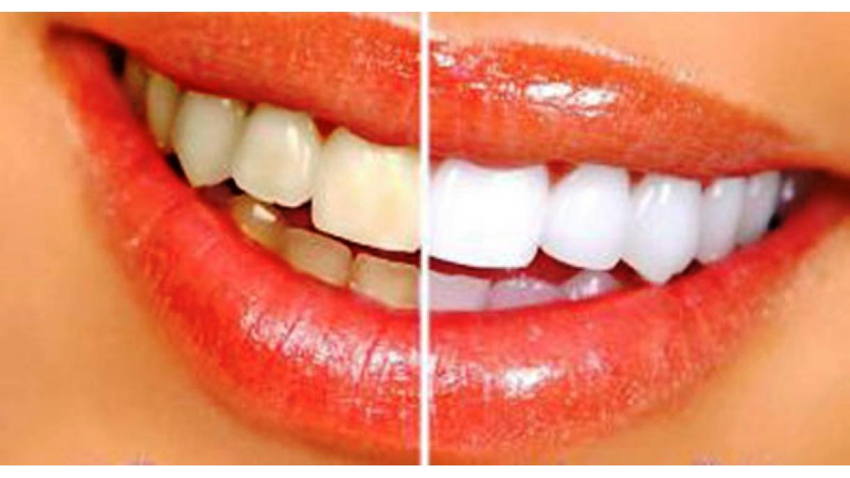 دانتوں کوموتیوں جیسا سفید اور چمکدار بنانے کے طریقے
