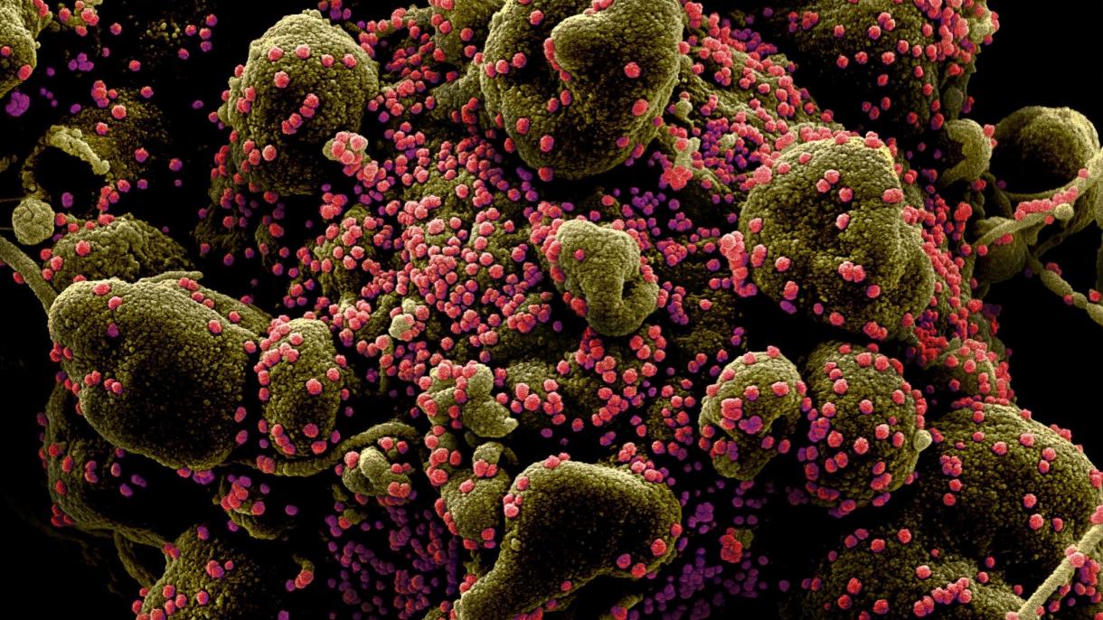 新冠病毒继续肆虐全球死亡病例已超13.2万人