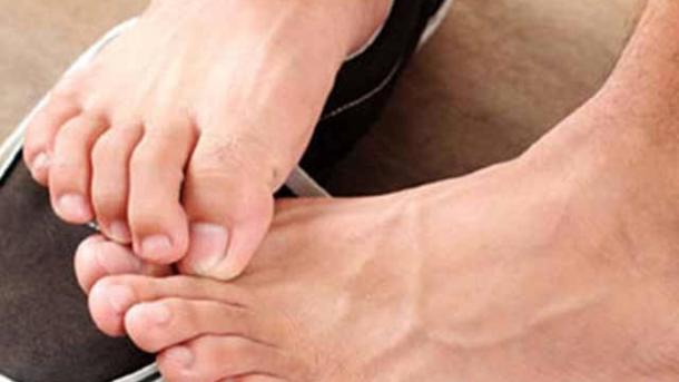 پاوں متعددامراض کی نشاندہی کرسکتے ہیں، ماہرین