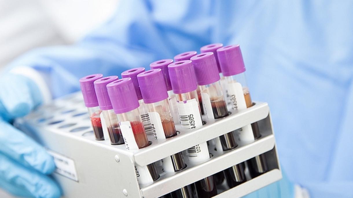 Amerikanyň 7 Ştatynda Maýmyn Mama Keseli Ýüze Çykdy