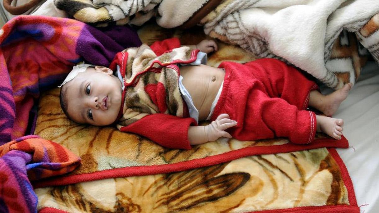 گزارش یونیسف در مورد وضعیت اسف بار کودکان یمنی