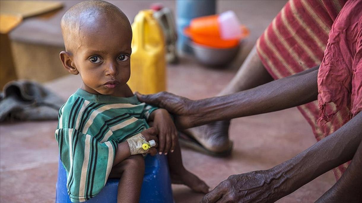 索马里50 万儿童面临被饿死的风险