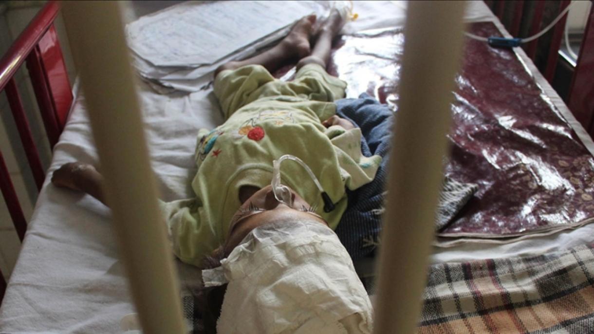 Subió a 35 el número de los casos de sarampión en Sudáfrica