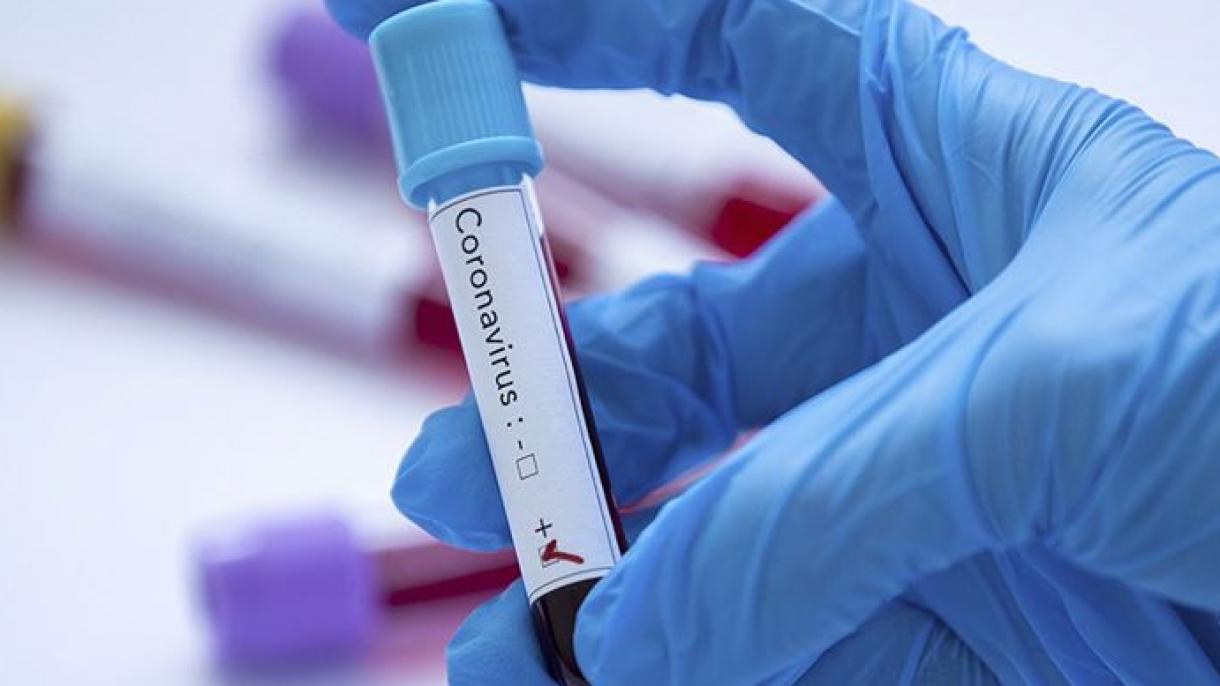 JSST, ba’zi davlatlarga koronavirusni aniqlaydigan test to‘plami tarqatmoqchi