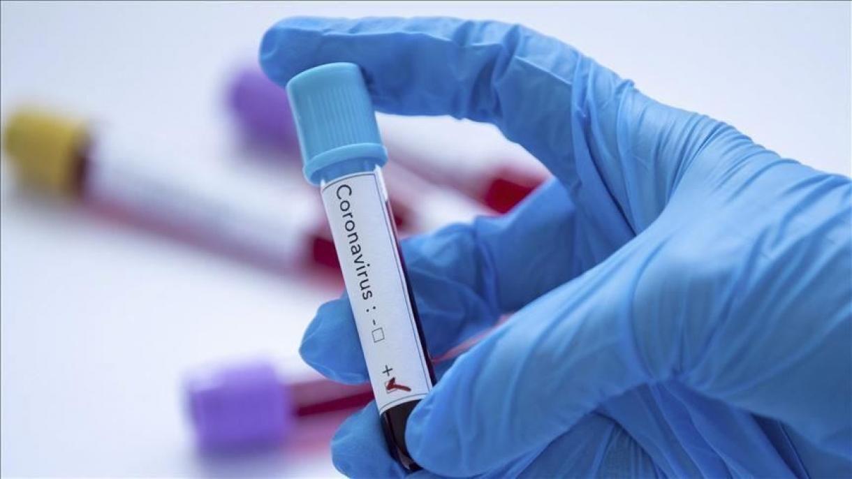 Il sistema turco "Diagnovir" sembra di sostituire i test PCR
