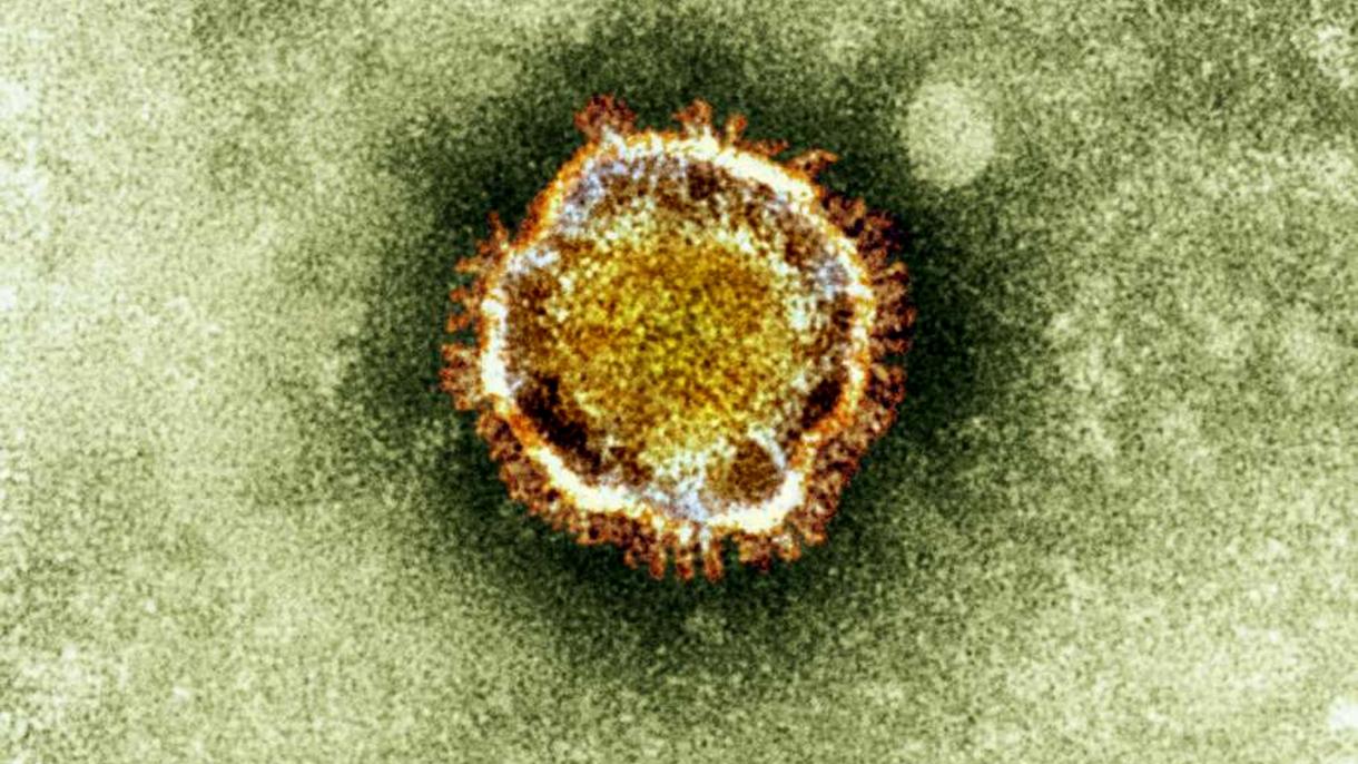 西半球新冠病毒疫情最新死亡数据